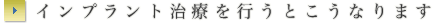 インプラント治療を行うとこうなります
