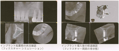 歯科用CTイメージ写真
