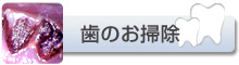 歯のお掃除
