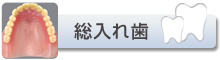 総入れ歯