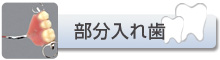 部分入れ歯