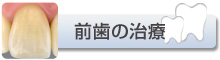 前歯の治療