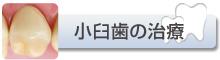 小臼歯の治療