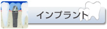 インプラント