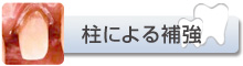 柱による補強