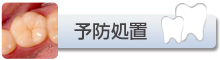 予防処置