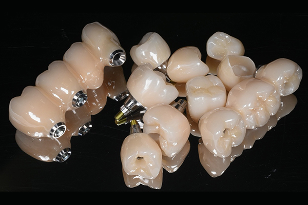 ジルコニアモノリシック