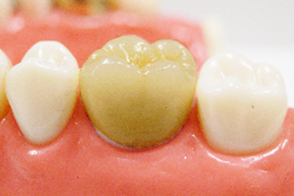 歯科医師との技工物の申し送りや確認