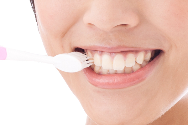 マウスピース矯正のメリット