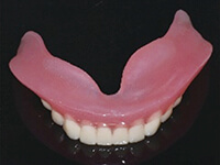 クッションのある義歯（生体用シリコン）