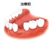 治療前