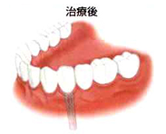 治療後