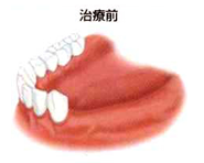 治療前