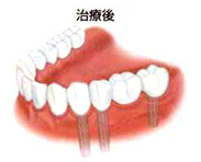 治療後