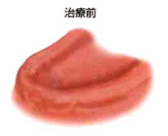 治療前