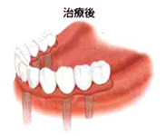治療後