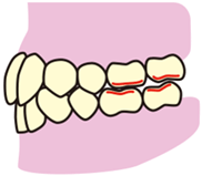 歯と歯ぐき